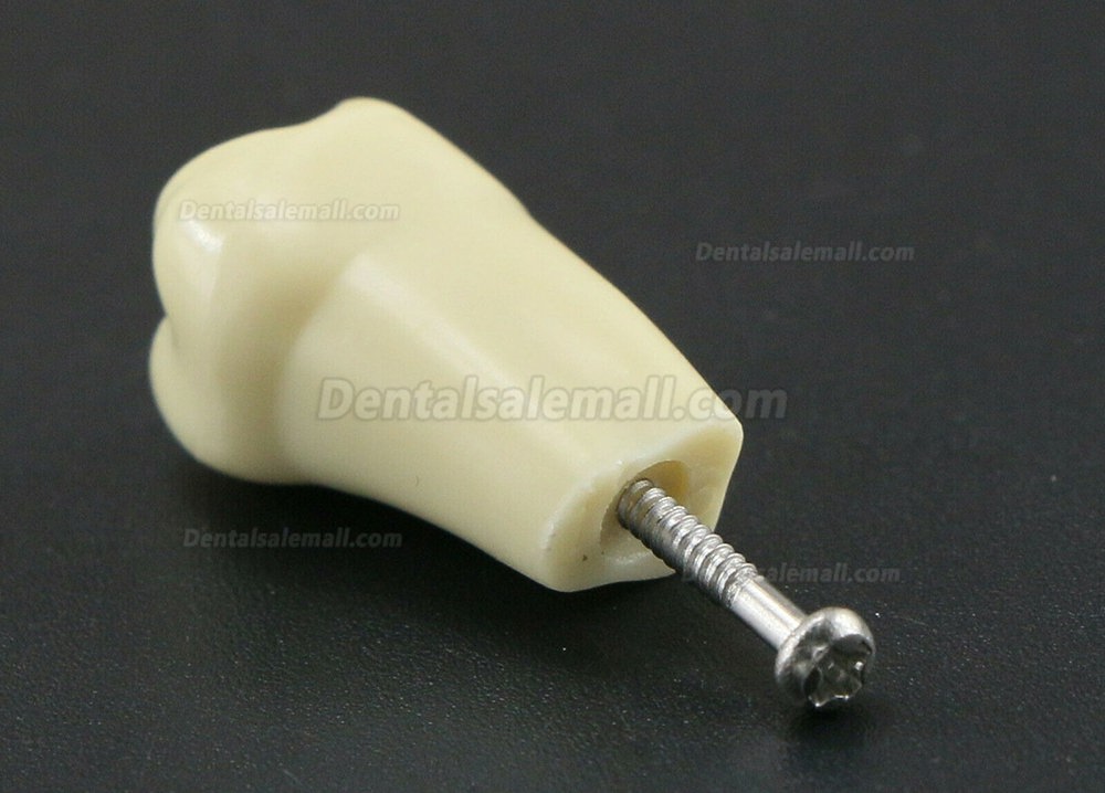 Dental Typodont Restorative Standard Simulation Model 32PCS Removable Teeth Compatible Frasaco AG3 Type